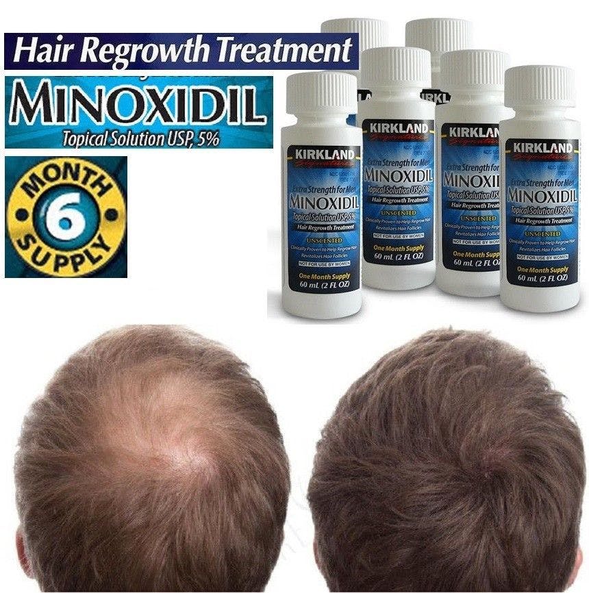 KIRKLAND MINOXIDIL 5%  (U.S.A) For Hair Growth